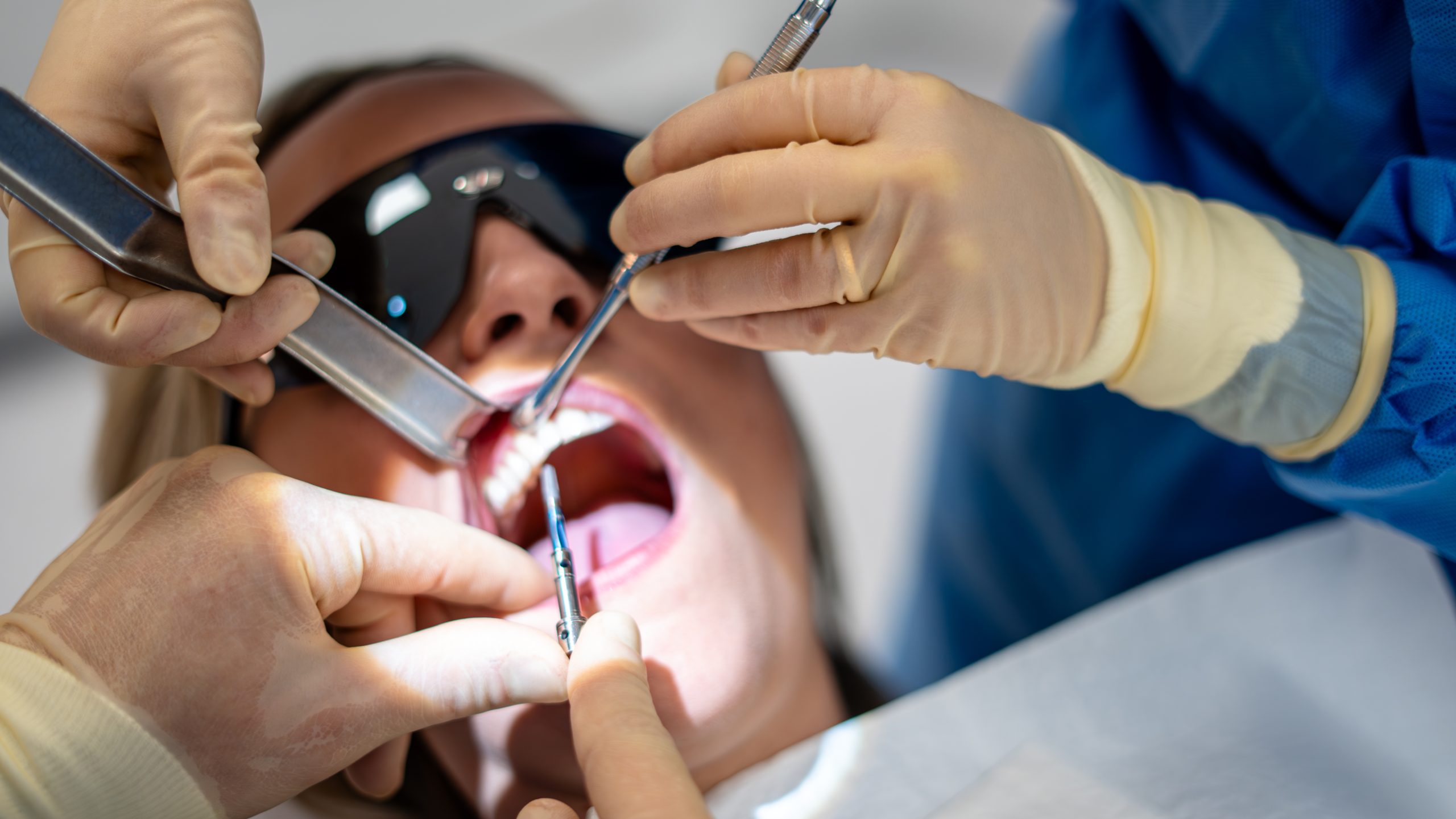 The Importance of Regular Dental Check-Ups